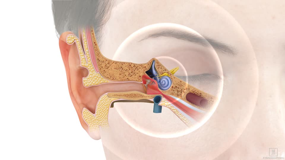 Tinnitus In One Ear: Causes, Treatments & New Research
